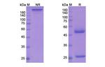 Secukinumab Antibody in SDS-PAGE (SDS-PAGE)