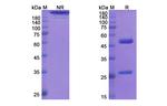 Rontalizumab Humanized Recombinant Human Monoclonal Antibody