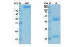 HIV1 gp120 (Suvizumab Biosimilar) Antibody in SDS-PAGE (SDS-PAGE)