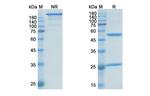 Dalotuzumab Humanized Antibody in SDS-PAGE (SDS-PAGE)