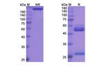 Benralizumab Humanized Antibody in SDS-PAGE (SDS-PAGE)