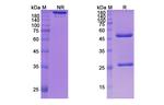 Mavrilimumab Antibody in SDS-PAGE (SDS-PAGE)