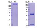 Teprotumumab Antibody in SDS-PAGE (SDS-PAGE)