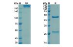 Drozitumab Recombinant Human Monoclonal Antibody