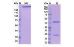 Ensituximab Chimeric Recombinant Human Monoclonal Antibody