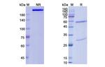 Foralumab Recombinant Human Monoclonal Antibody