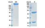 Itolizumab Humanized Antibody in SDS-PAGE (SDS-PAGE)