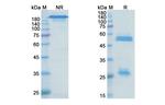 Olaratumab Antibody in SDS-PAGE (SDS-PAGE)
