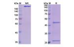 Olokizumab Humanized Antibody in SDS-PAGE (SDS-PAGE)