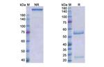 Roledumab Recombinant Human Monoclonal Antibody