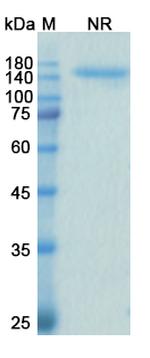 CD200 (Samalizumab Biosimilar) Antibody in SDS-PAGE (SDS-PAGE)