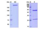CCL2 (MCP-1) (Carlumab Biosimilar) Antibody in SDS-PAGE (SDS-PAGE)