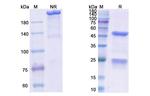 Enavatuzumab Humanized Recombinant Human Monoclonal Antibody