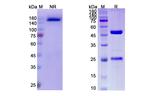 Enokizumab Humanized Recombinant Human Monoclonal Antibody