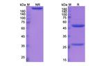 Etrolizumab Humanized Recombinant Human Monoclonal Antibody