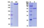 Fulranumab Recombinant Human Monoclonal Antibody