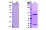 Icrucumab Antibody in SDS-PAGE (SDS-PAGE)