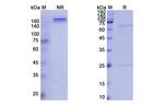 Amyloid Precursor Protein (Ponezumab Biosimilar) Recombinant Humanized mouse Monoclonal Antibody