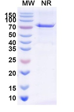 Radretumab Recombinant Human Monoclonal Antibody