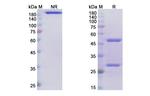 Tregalizumab Humanized Antibody in SDS-PAGE (SDS-PAGE)