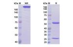 Ublituximab Chimeric Recombinant Human Monoclonal Antibody