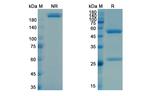 Neuropilin 1 (CD304) (Vesencumab Biosimilar) Recombinant Human Monoclonal Antibody