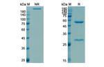 Blosozumab Humanized Antibody in SDS-PAGE (SDS-PAGE)