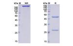 Crenezumab Humanized Antibody in SDS-PAGE (SDS-PAGE)