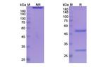 Ficlatuzumab Humanized Recombinant Human Monoclonal Antibody