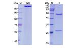 TNF beta (Pateclizumab Biosimilar) Recombinant Humanized mouse Monoclonal Antibody