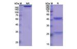 Tabalumab Recombinant Human Monoclonal Antibody