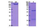 Indatuximab Chimeric Recombinant Human Monoclonal Antibody