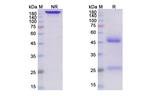 Sarilumab Antibody in SDS-PAGE (SDS-PAGE)