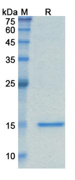 Caplacizumab Humanized Recombinant Human Monoclonal Antibody