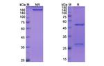 Inclacumab Recombinant Human Monoclonal Antibody
