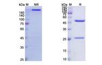 TYRP1 (Flanvotumab Biosimilar) Recombinant Human Monoclonal Antibody