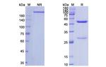 Sclerostin (Romosozumab Biosimilar) Antibody in SDS-PAGE (SDS-PAGE)