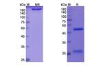 Quilizumab Humanized Recombinant Human Monoclonal Antibody