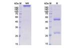 Her-3 (ErbB3) (Patritumab Biosimilar) Recombinant Human Monoclonal Antibody
