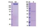 Actoxumab Recombinant Human Monoclonal Antibody