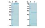 Bezlotoxumab Recombinant Human Monoclonal Antibody