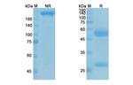 Alirocumab Antibody in SDS-PAGE (SDS-PAGE)