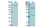 Clazakizumab Humanized Antibody in SDS-PAGE (SDS-PAGE)