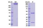 Enoticumab Antibody in SDS-PAGE (SDS-PAGE)