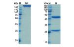 NGF (Fasinumab Biosimilar) Recombinant Human Monoclonal Antibody
