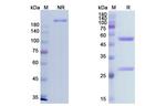 Imgatuzumab Humanized Antibody in SDS-PAGE (SDS-PAGE)