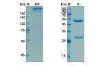 Ligelizumab Humanized Recombinant Human Monoclonal Antibody
