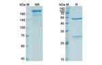 Parsatuzumab Humanized Recombinant Human Monoclonal Antibody