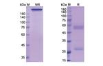 Perakizumab Humanized Recombinant Human Monoclonal Antibody