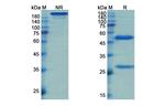LOXL2 (Simtuzumab Biosimilar) Antibody in SDS-PAGE (SDS-PAGE)
